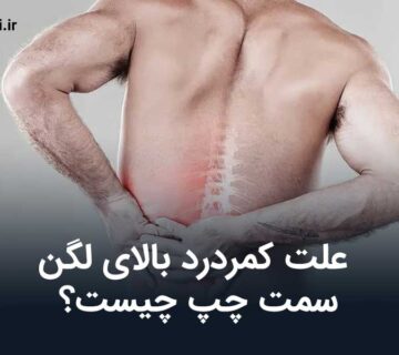 کمردرد بالای لگن سمت چپ