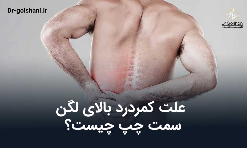 کمردرد بالای لگن سمت چپ
