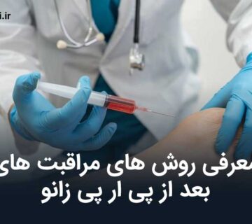 مراقبت های بعد از پی ار پی زانو