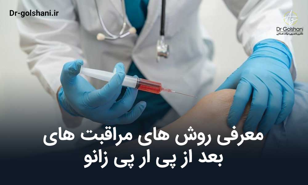 مراقبت های بعد از پی ار پی زانو