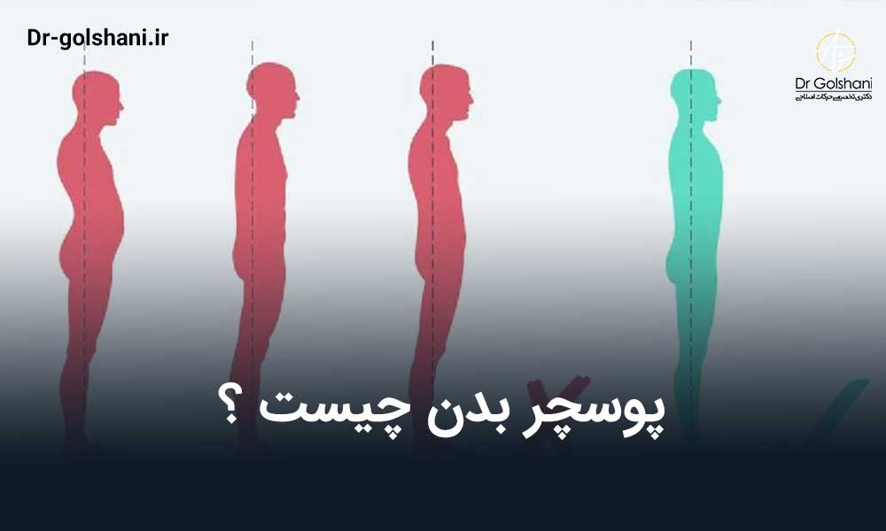 پوسچر بدن چیست