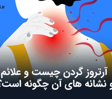 آرتروز گردن
