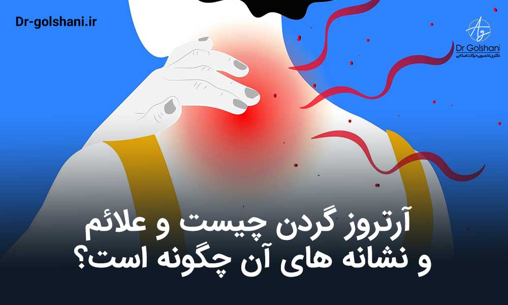 آرتروز گردن