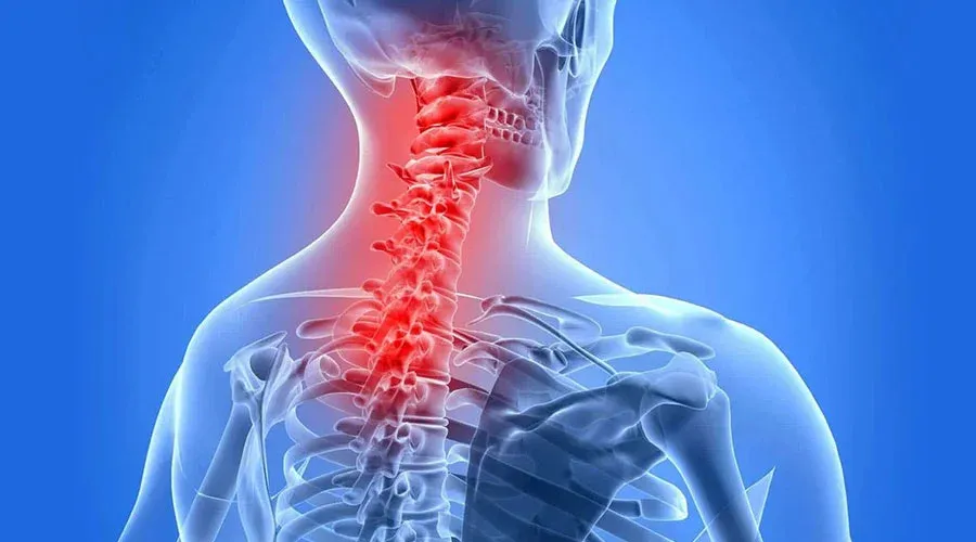 آرتروز گردن و بدنسازی چگونه بر هم تأثیر میگذارند؟