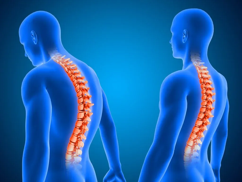 خطرات پوسچر نامناسب بدن