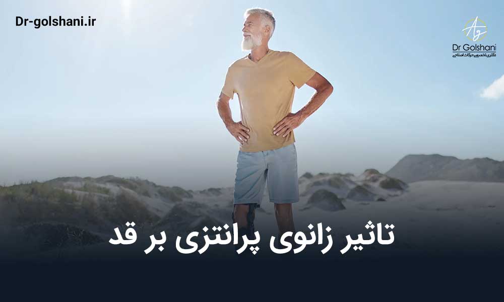 تاثیر زانوی پرانتزی بر قد