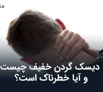 دیسک گردن خفیف