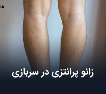 زانو پرانتزی در سربازی