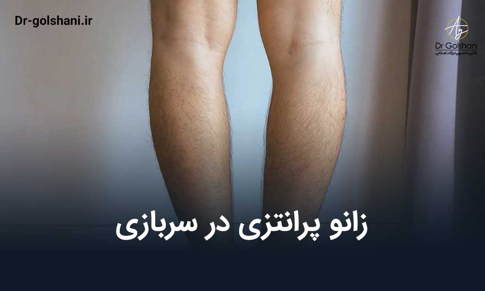 زانو پرانتزی در سربازی