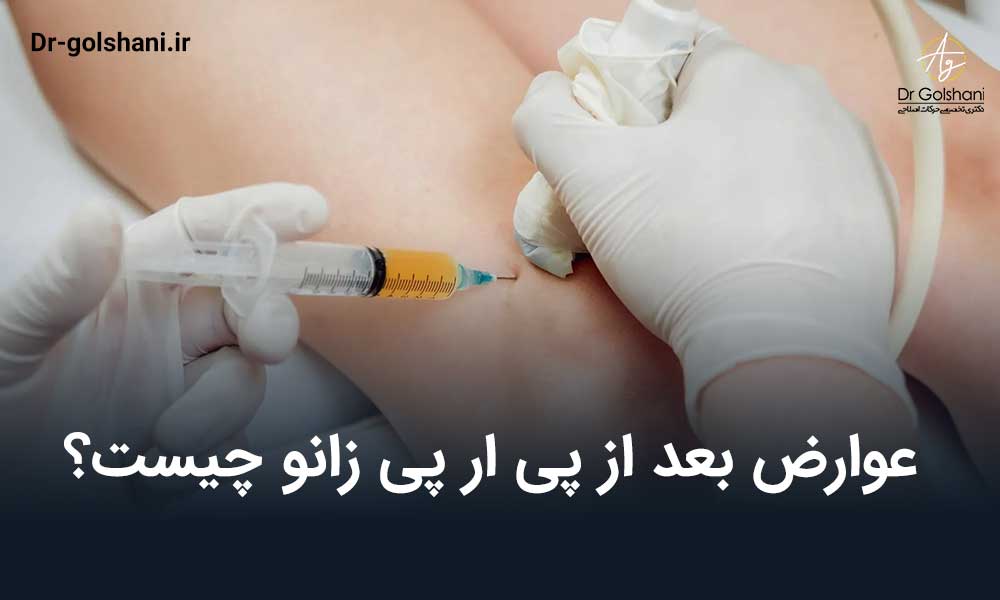 عوارض بعد از پی ار پی زانو چیست