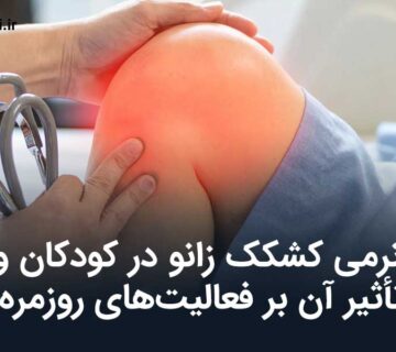 نرمی کشکک زانو در کودکان و تأثیر آن بر فعالیت‌های روزمره