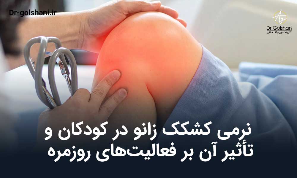 نرمی کشکک زانو در کودکان و تأثیر آن بر فعالیت‌های روزمره