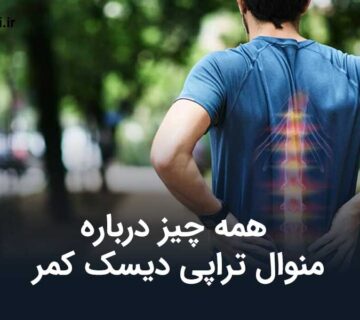 منوال تراپی دیسک کمر