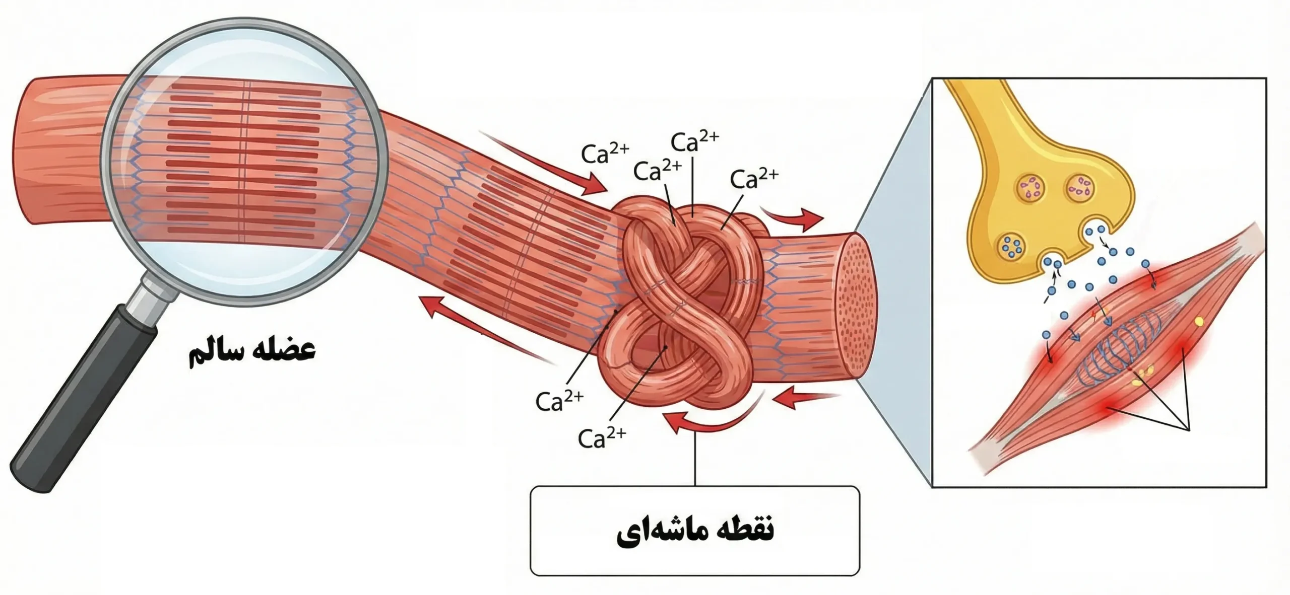 چرا نقاط ماشه ای ایجاد میشوند؟