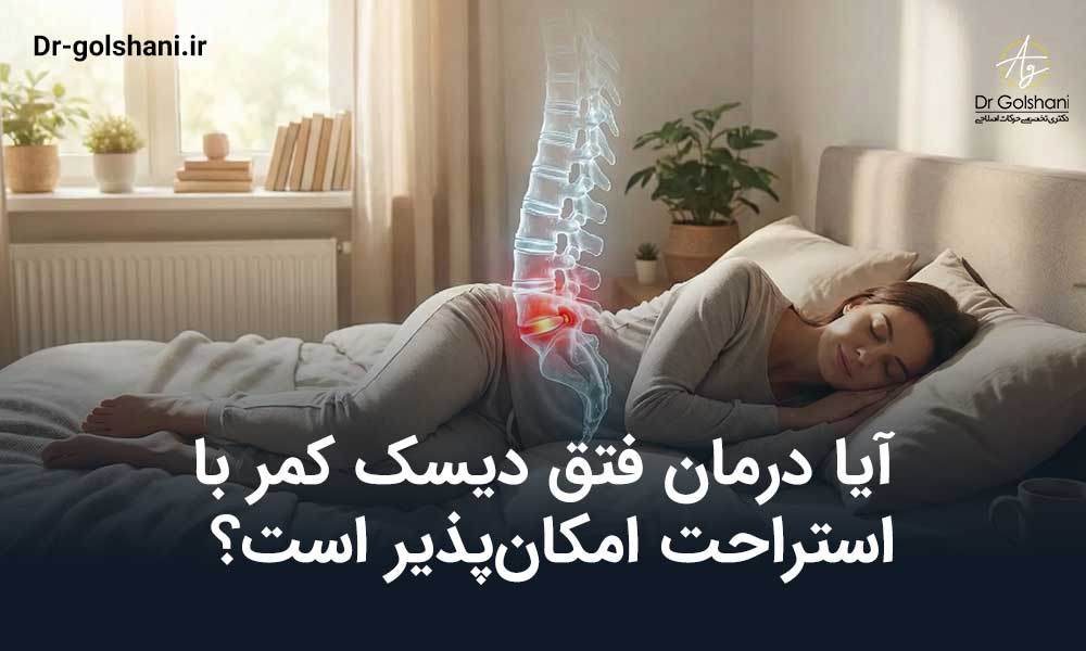 آیا درمان فتق دیسک کمر با استراحت امکان‌پذیر است؟