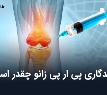 ماندگاری پی ار پی زانو چقدر است