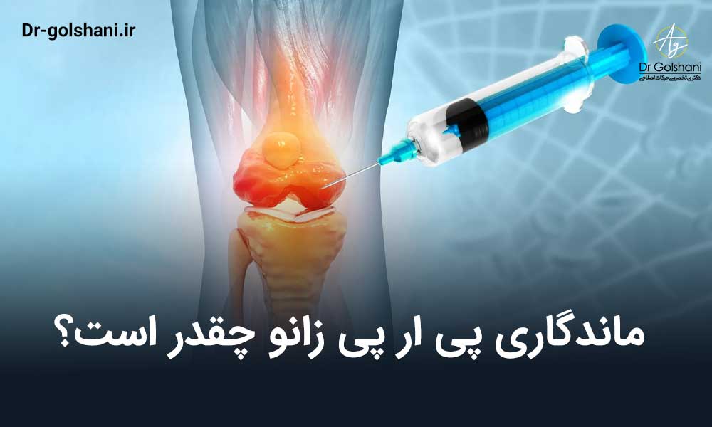 ماندگاری پی ار پی زانو چقدر است