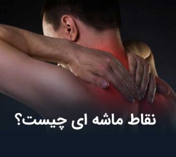 نقاط ماشه ای