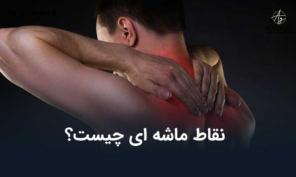 نقاط ماشه ای