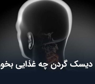 برای دیسک گردن چه غذایی بخوریم؟