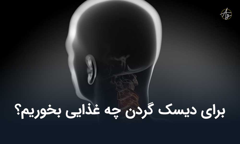 برای دیسک گردن چه غذایی بخوریم؟