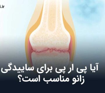پی ار پی برای ساییدگی زانو