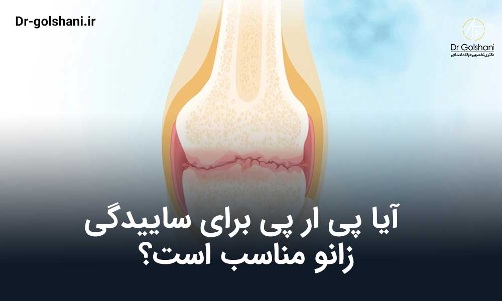 پی ار پی برای ساییدگی زانو
