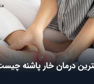 درمان خار پاشنه
