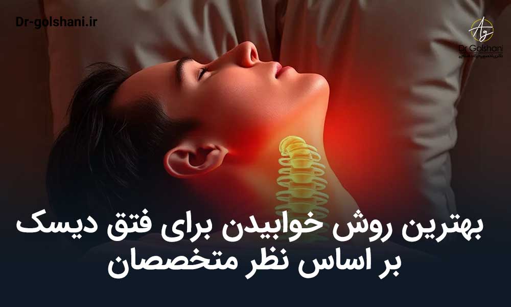 بهترین روش خوابیدن برای فتق دیسک