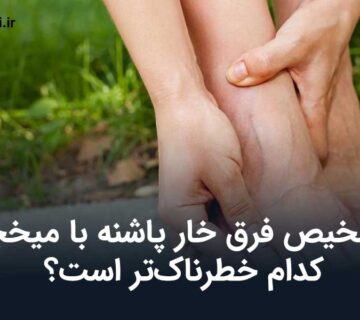 فرق خار پاشنه با میخچه