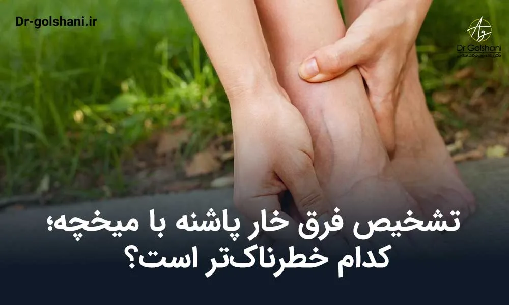 فرق خار پاشنه با میخچه