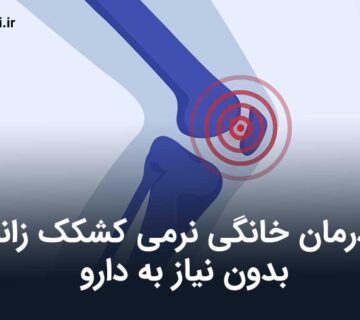 درمان خانگی نرمی کشکک زانو