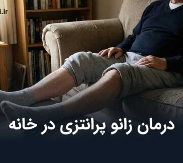 درمان زانو پرانتزی در خانه